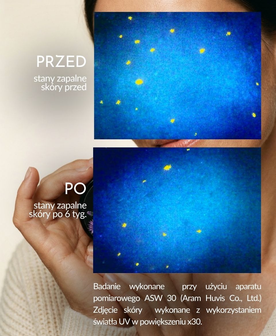 Youth Nectar • serum jagodowe, roślinna alternatywa retinolu - obrazek 8